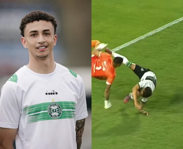 Atacante do Coritiba quebra o braço em jogo de estreia pelo Paranaense